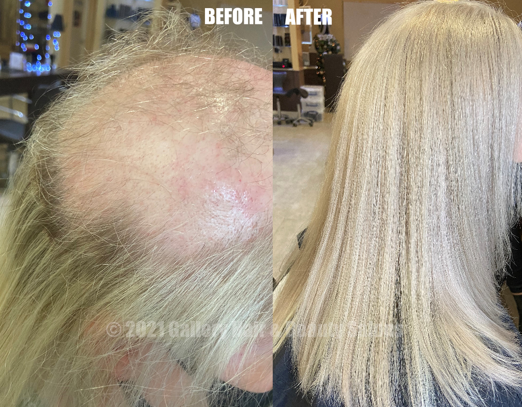 Volumizer Hair Replacement System